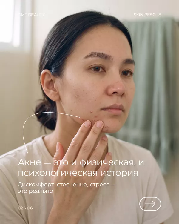 Акне и самоощущение